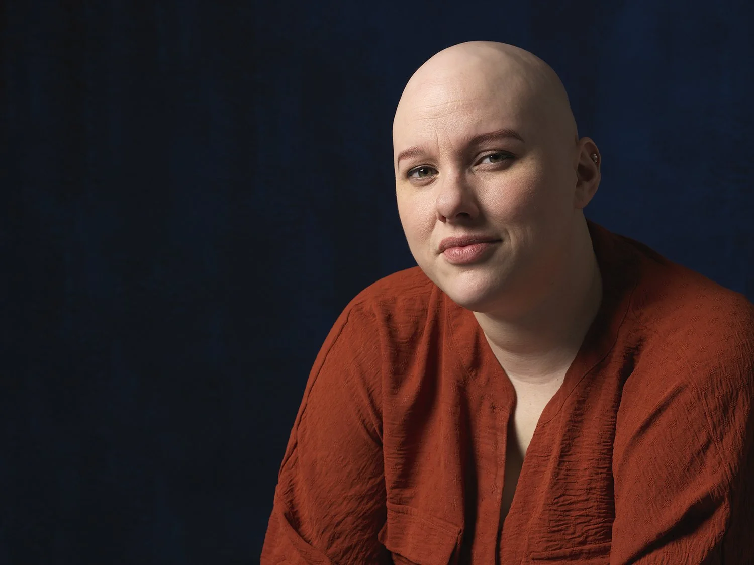 대머리 모습: 이 탈모증 생존자는 가발 뒤에 숨기를 거부합니다.